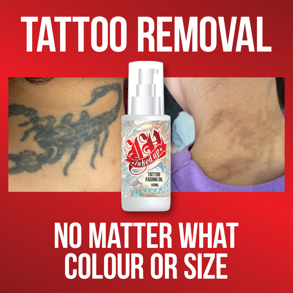 Does Tattoo Removal Cream Work What Dermatologists Recommend 2023